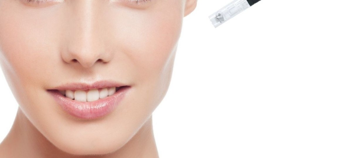 whatismicroneedling