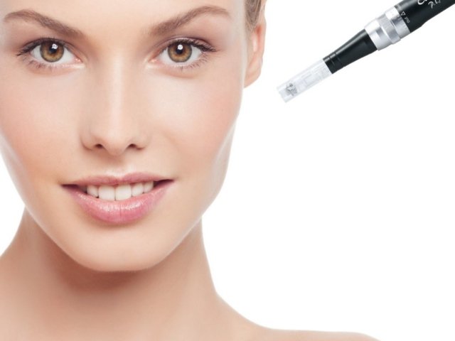 whatismicroneedling