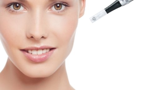 MD Needle Pen Microneedling