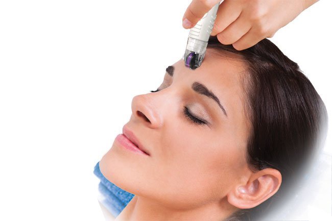 DermaFrac Microneedling